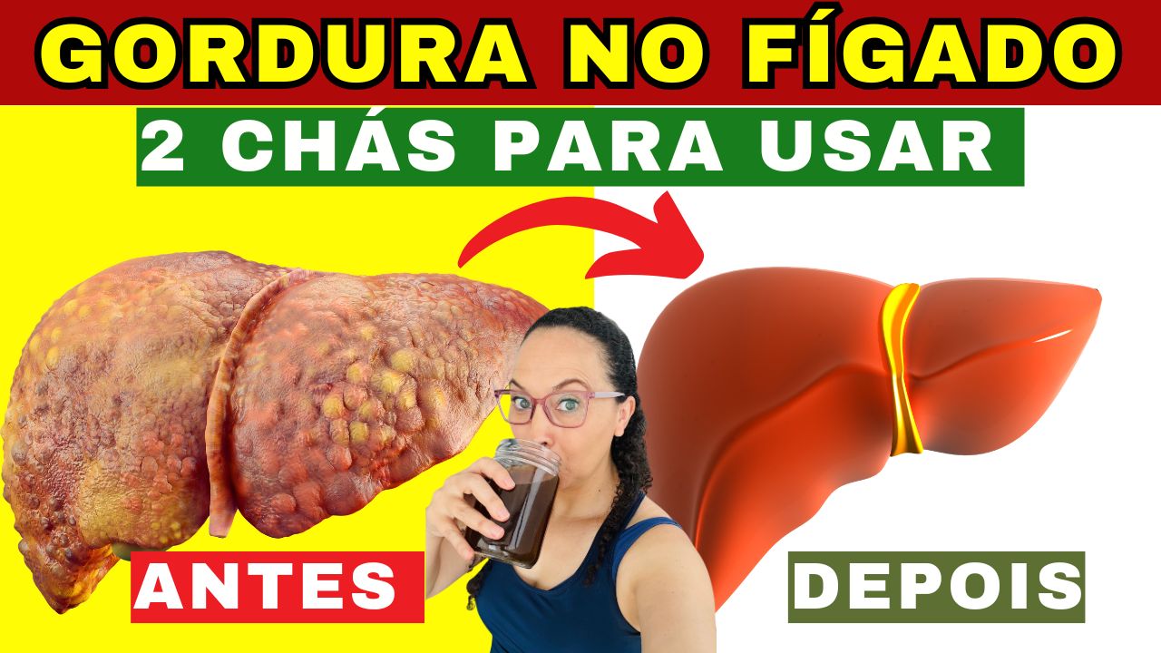 Fígado Gorduroso Depois dos 45: 2 Chás que Ajudam de Verdade a limpeza do corpo